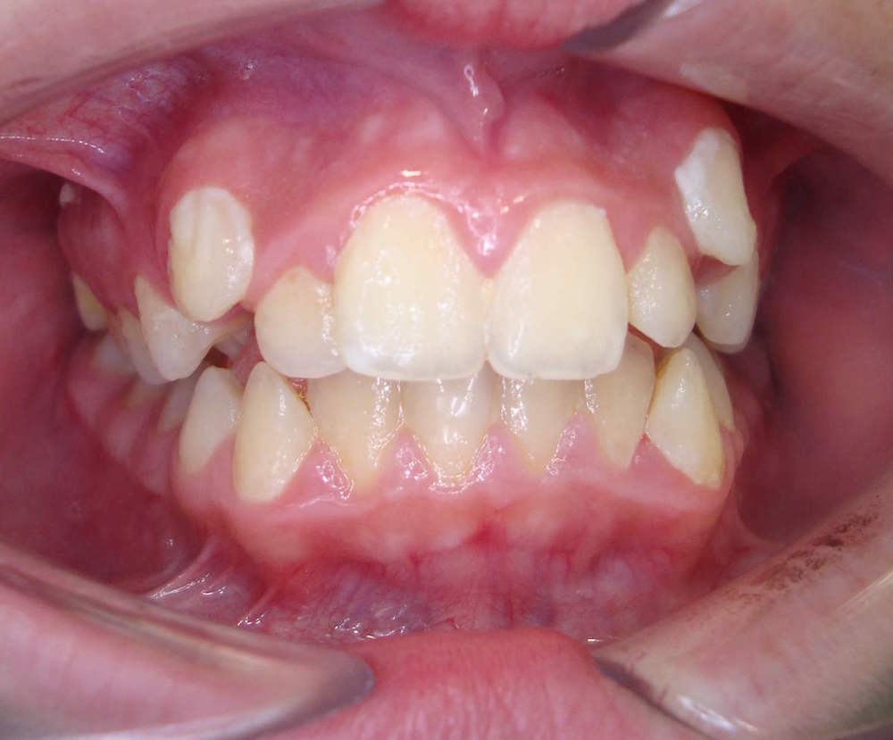 ortodontia1.1.JPG