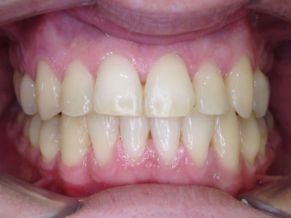 ortodontia3.2.JPG